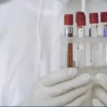 Estados Unidos aprovam uso de exame de sangue para detectar Alzheimer