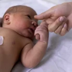 Teste do olhinho deve ser repetido três vezes ao ano até os 3 anos